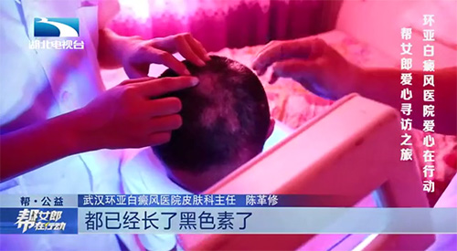 爱心寻贝治白斑,环亚公益诊疗到监利 爱心寻贝治白斑,环亚公益诊疗到监利