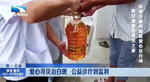 爱心寻贝治白斑,环亚公益诊疗到监利 爱心寻贝治白斑,环亚公益诊疗到监利
