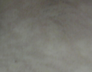 人ưõҽԺӰ