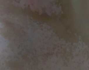 人ưװߵҽԺ人ƻݵЩأ